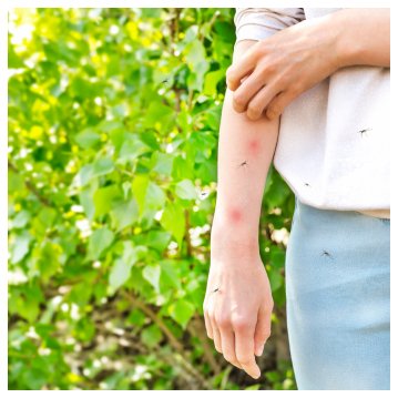 Mosquito Control in Phoenix, Tucson, & the East Valley